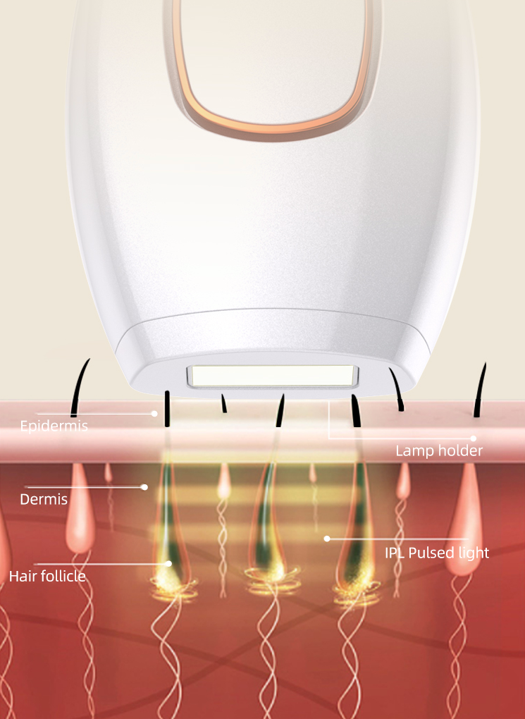 IPL Laser Hair Removal At Home Handset